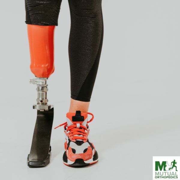 Person with a red prosthetic leg wearing black athletic leggings and red sneakers, showcasing resilient amputation rehabilitation in Brooklyn. Mutual Orthopedics logo in the bottom right corner. Person with a red prosthetic leg wearing black athletic leggings and red sneakers, showcasing resilient amputation rehabilitation in Brooklyn Mutual Orthopedics logo in the bottom right corner