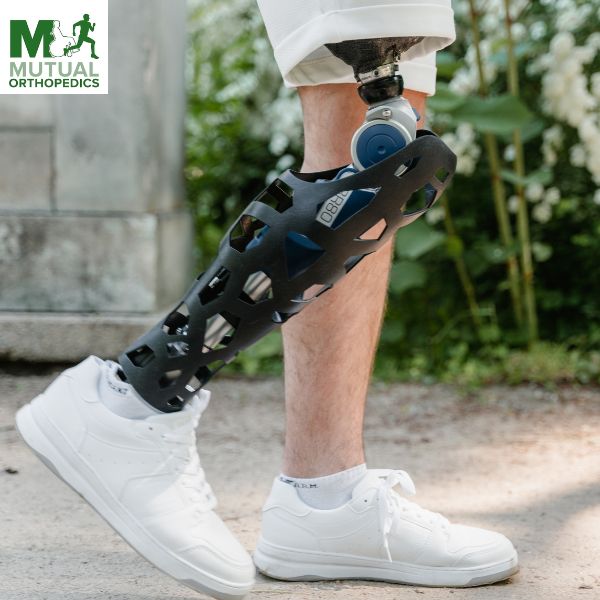 A person, undergoing amputation rehabilitation in Islandia, is standing outdoors with a prosthetic leg featuring a lattice design and wearing white sneakers. A person, undergoing amputation rehabilitation in Islandia, is standing outdoors with a prosthetic leg featuring a lattice design and wearing white sneakers