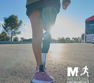 Mental and Emotional Health After Amputation: Finding Support and Strength mutual ortho blog