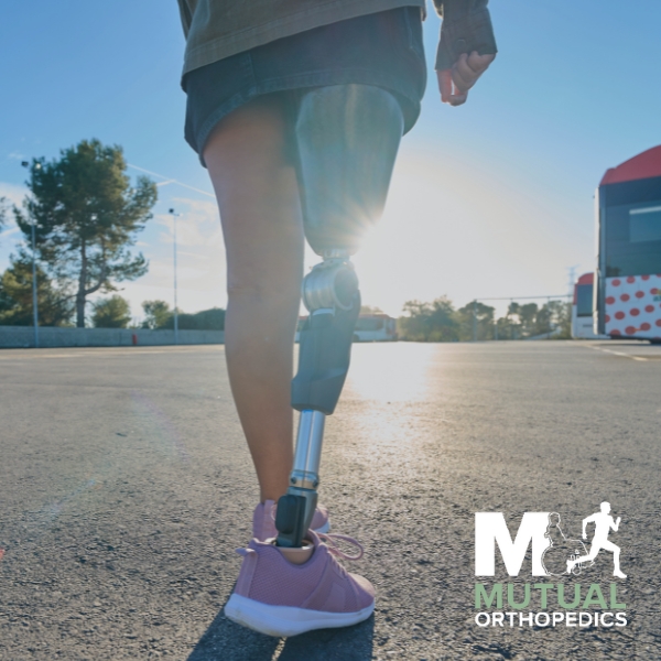 Mental and Emotional Health After Amputation: Finding Support and Strength mutual ortho blog