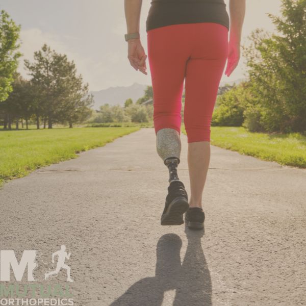 A person with a prosthetic leg walks on a paved path in a park, wearing red leggings and black shoes The scene is sunny with greenery on both sides