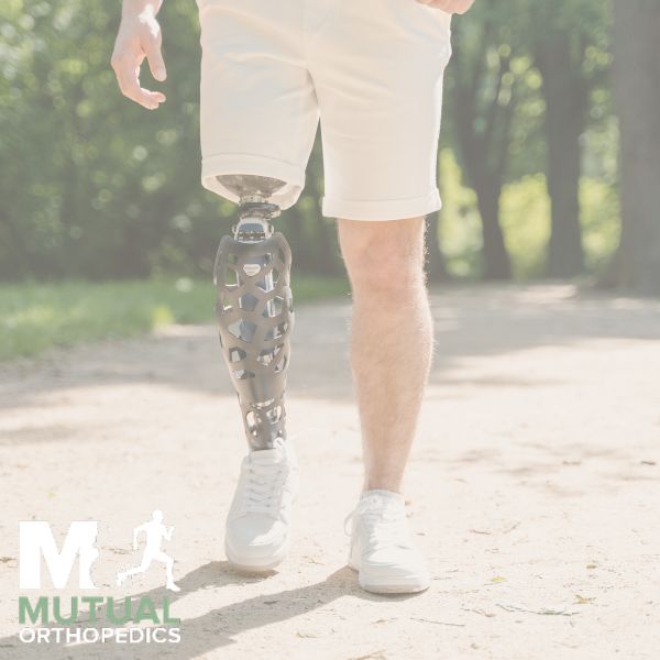 A person with a prosthetic leg walks on a dirt path in a park, wearing white shorts and sneakers  "Mutual Orthopedics" logo appears in the bottom left corner 